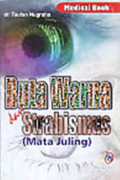 BUTA WARNA DAN STRABISMUS (MATA JULING)