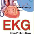 EKG Cara Praktis Baca Elektrokardiografi